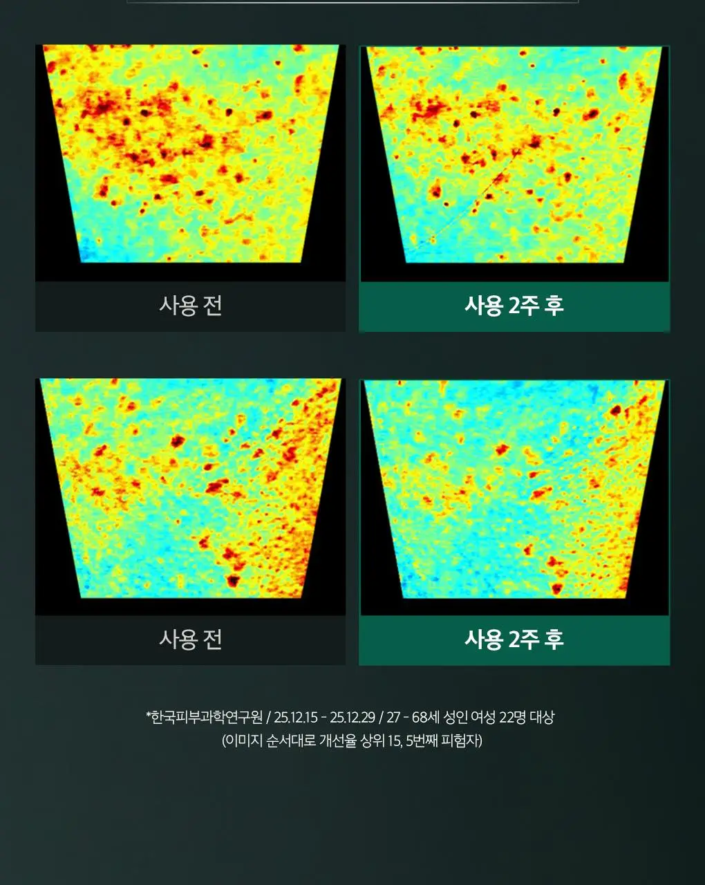 [이달의신상] 오휘 기미케어 3-STEP 콜라겐 톤업선 50ml / 데니어 팩트 리필 기획 / 멜라토닝 크림 60ml 상세페이지 61